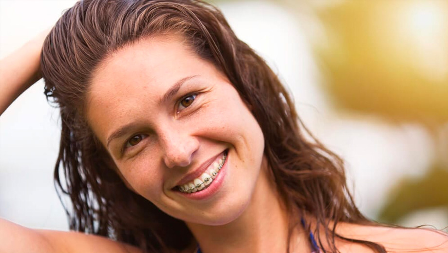 img-treatment-Braces-for-adults-03