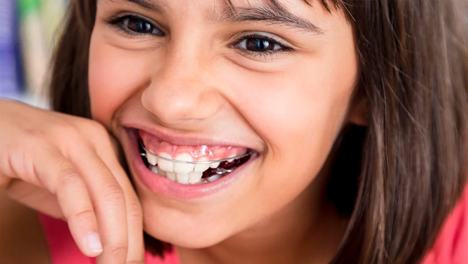 img-treatment-retainers-02